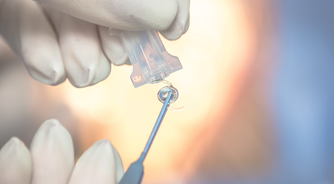 白内障治療について